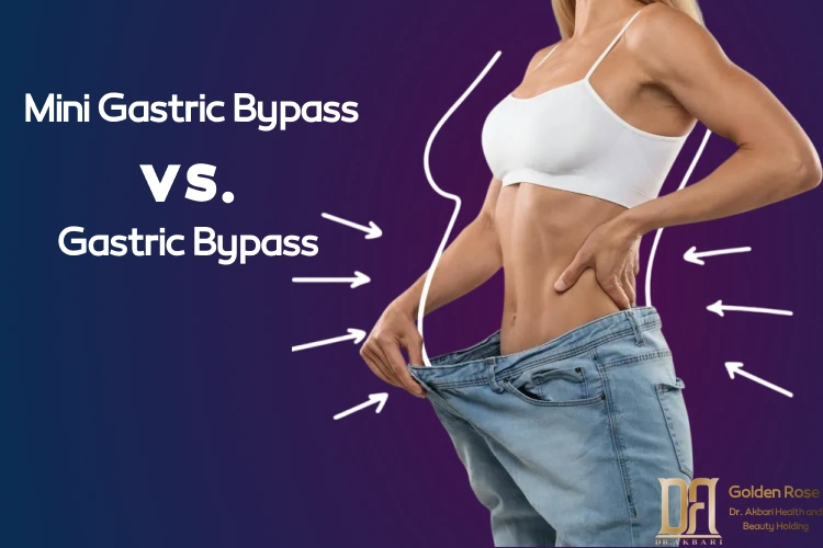 Gastric Bypass vs. Mini Gastric Bypass: A Complete Guide to Obesity Surgery